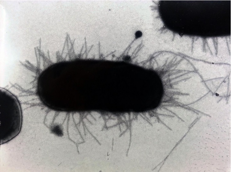 Les souches de superbactéries E. coli peuvent persister dans les intestins de femmes en bonne santé