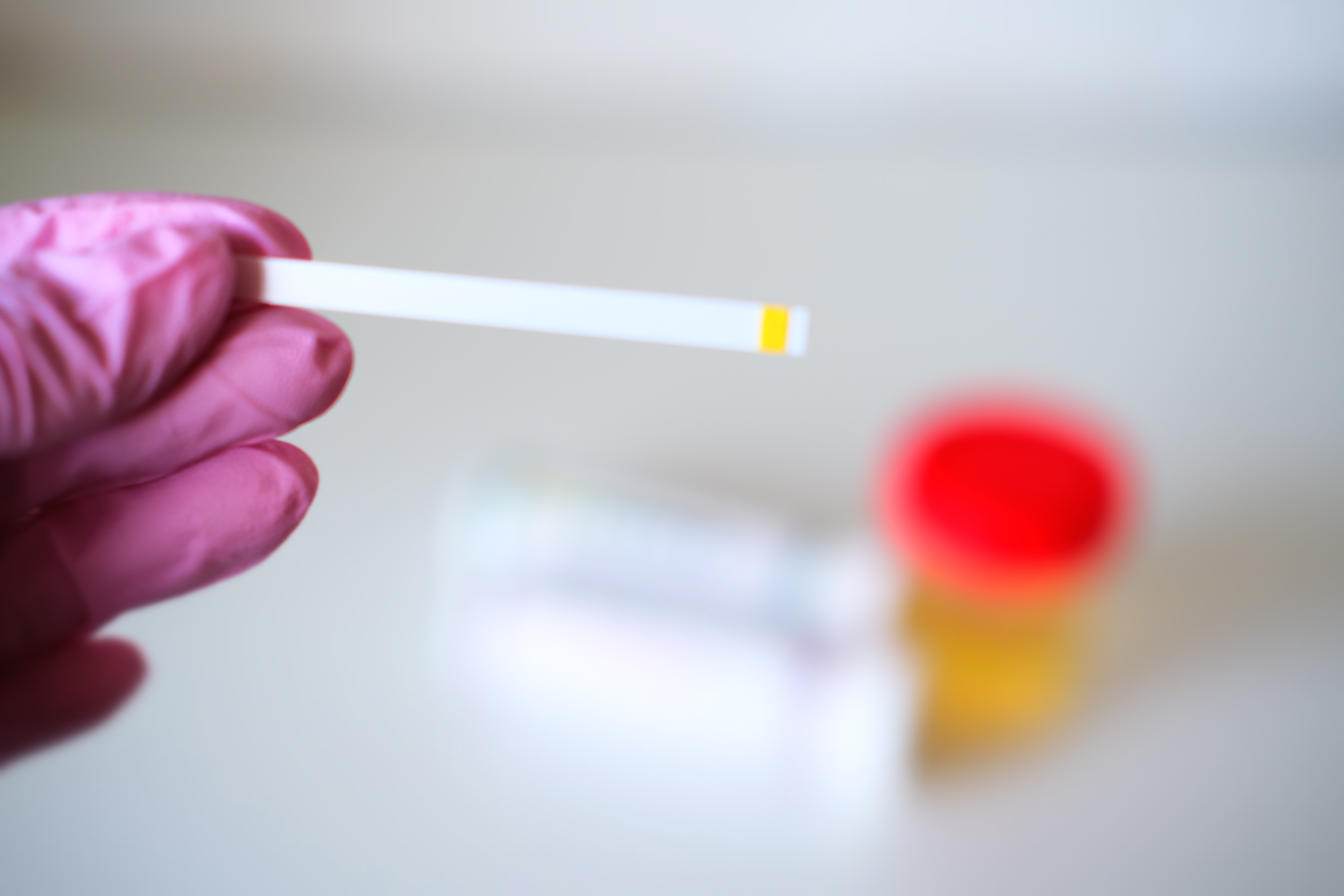 Ce test génétique urinaire pourrait prédire le cancer de la vessie des années avant le diagnostic (Visuel Adobe Stock 350279331)