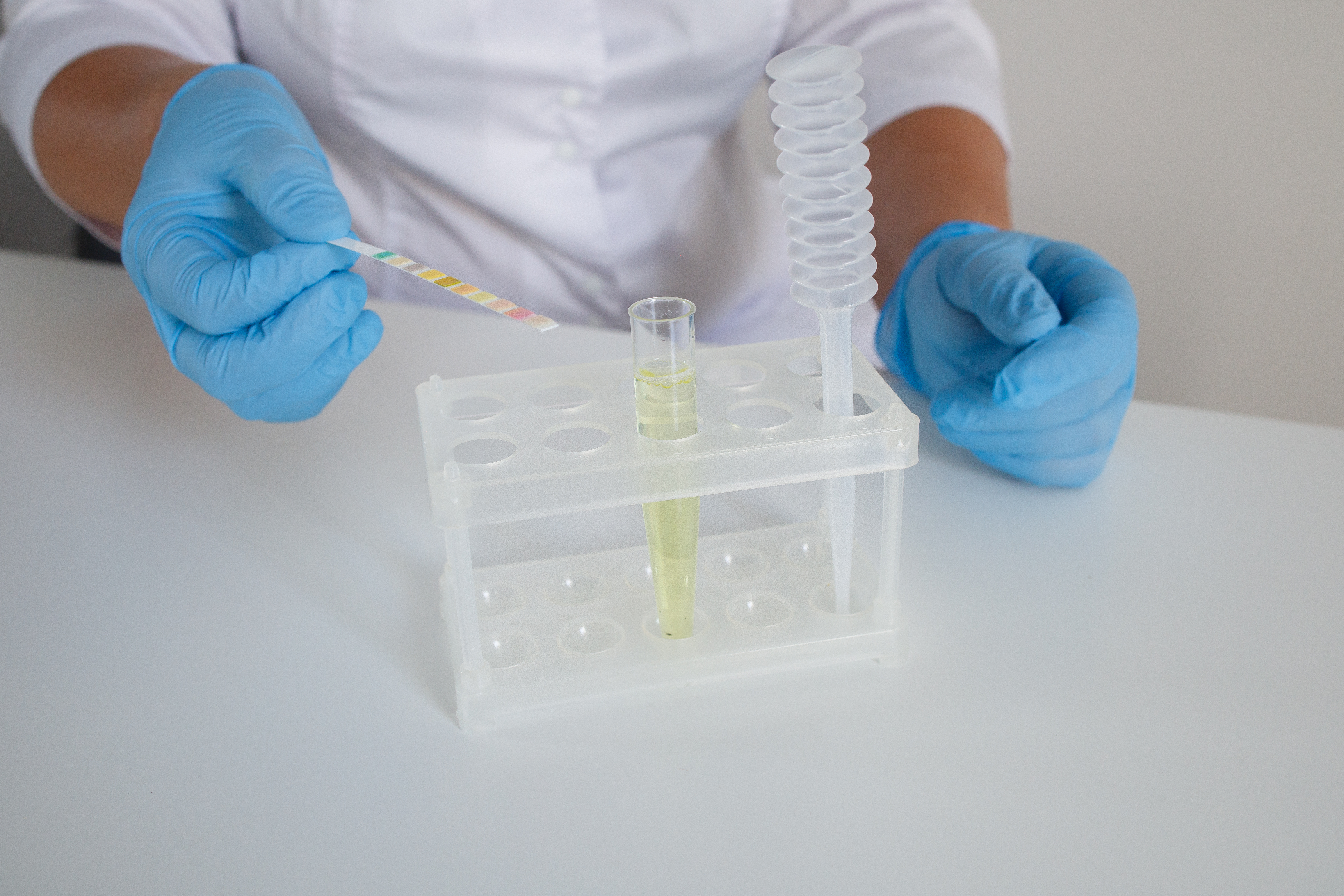 &laquo; MyProstateScore &raquo;, c&rsquo;est le nom donn&eacute; &agrave; ce nouveau test urinaire capable de d&eacute;tecter un cancer agressif de la prostate (Visuel Adobe Stock 1116267100)
